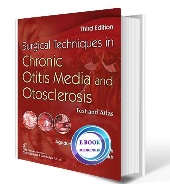 دانلود کتاب  Surgical Techniques in Chronic Otitis Media and Otosclerosis Text and Atlas2020( ORIGINAL PDF)